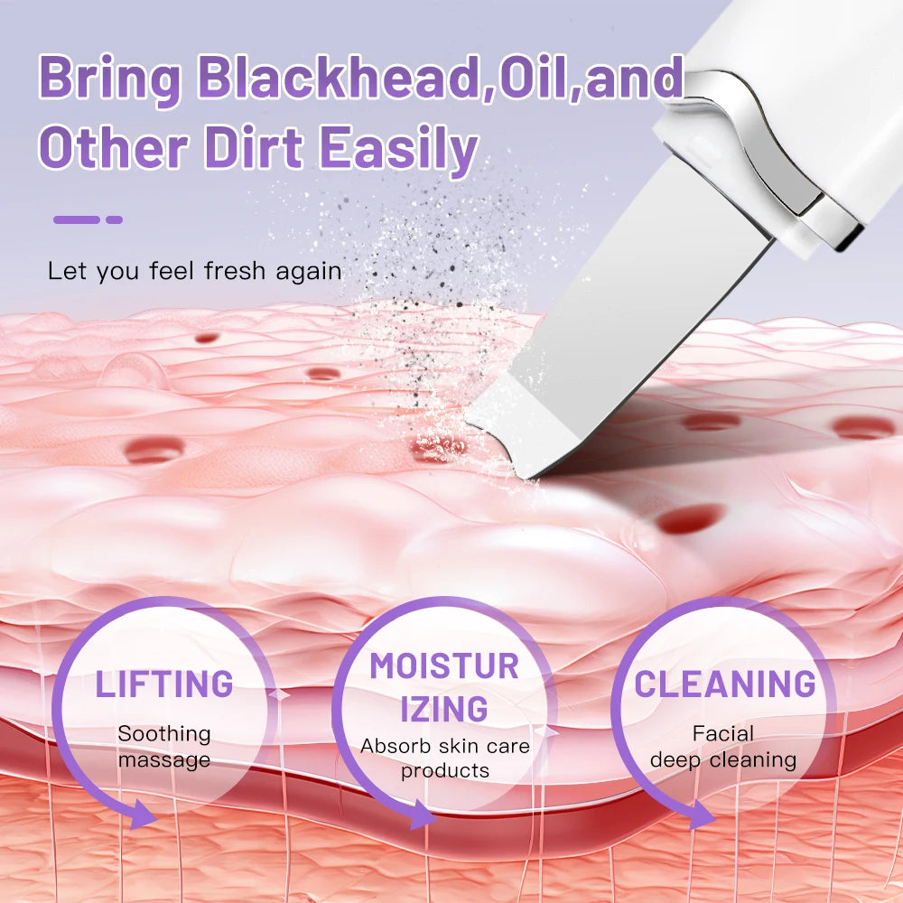 Ultrasonic Skin Scrubber Electric Skin Scrubber Deep Face Cleaning Peeling Shovel Facial Pore Cleaner Blackhead Removal Lifting