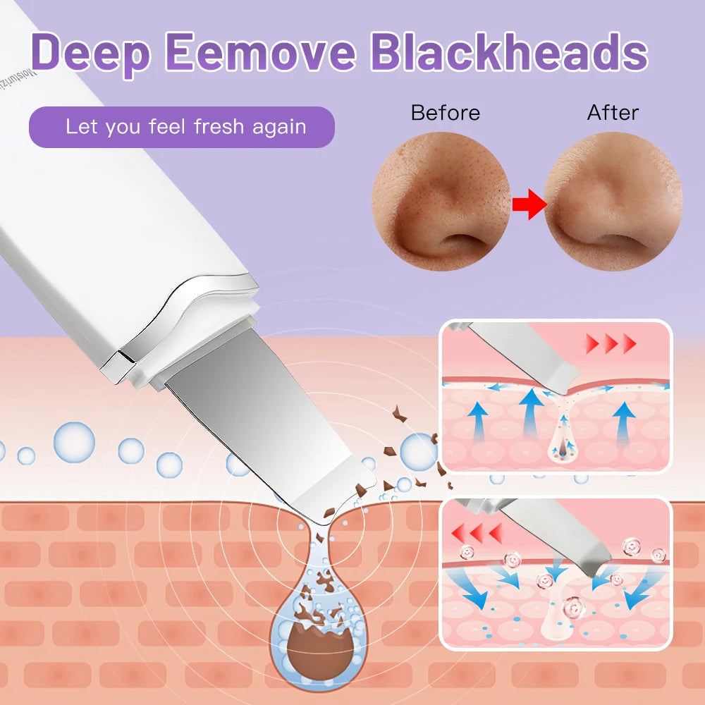 Ultrasonic Skin Scrubber Electric Skin Scrubber Deep Face Cleaning Peeling Shovel Facial Pore Cleaner Blackhead Removal Lifting