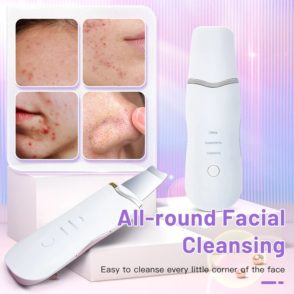 Ultrasonic Skin Scrubber Electric Skin Scrubber Deep Face Cleaning Peeling Shovel Facial Pore Cleaner Blackhead Removal Lifting